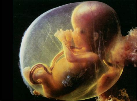 feto en líquido amniótico